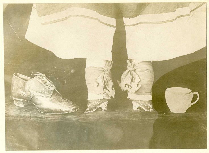 10. Bound feet of a Chinese woman compared to teacup and normal woman feet
