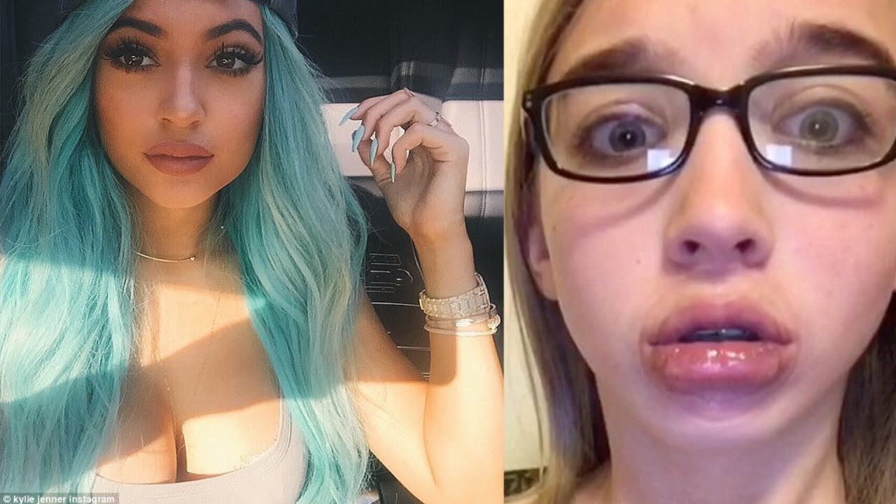 When The Kylie Jenner Lip Transformation Challenge Goes Wrong Epic Fails