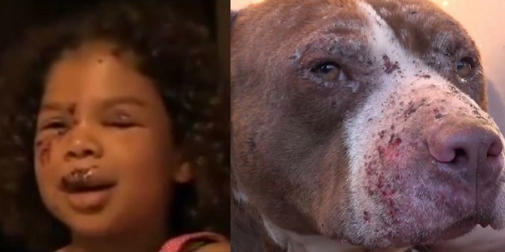 Heroic Pit Bull Saved Little Girl From A Deadly Dog Attack